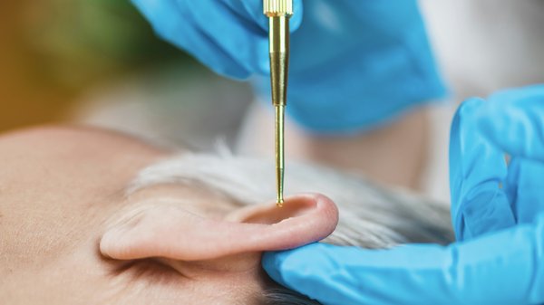 Réflexologie auriculaire au laser: une solution aux addictions